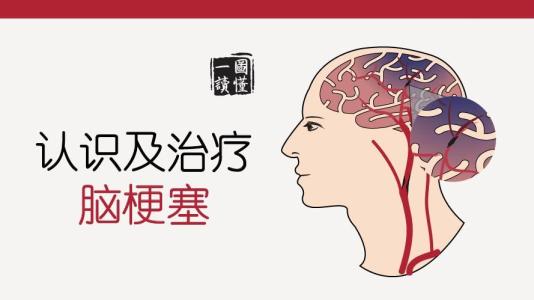 認(rèn)識和治療腦梗塞