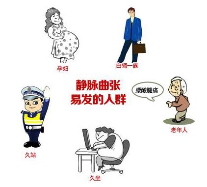 靜脈曲張易發(fā)人群