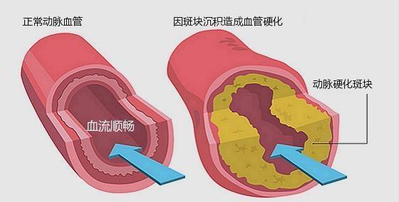 文山三七可以通暢血管